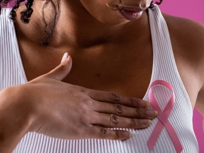 Breast Cancer